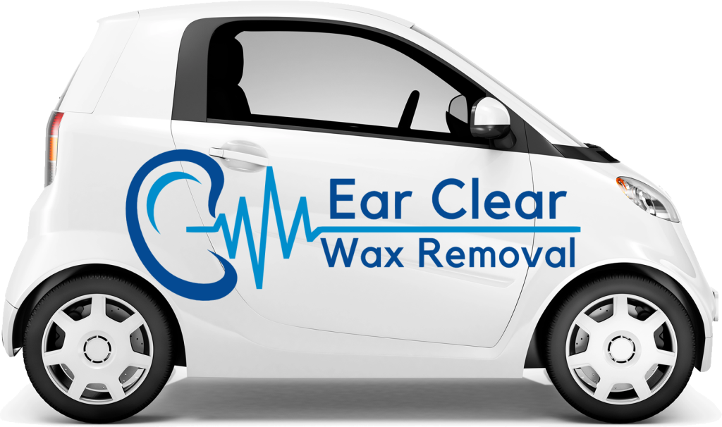Mobile Ear Wax Removal