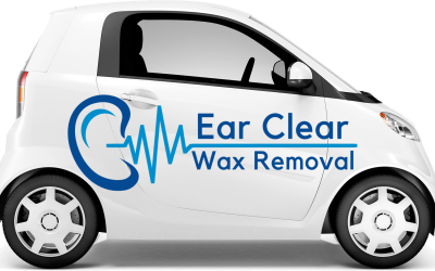 Mobile Ear Wax Cleaning Services